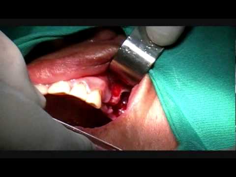 How to more views on youtube video