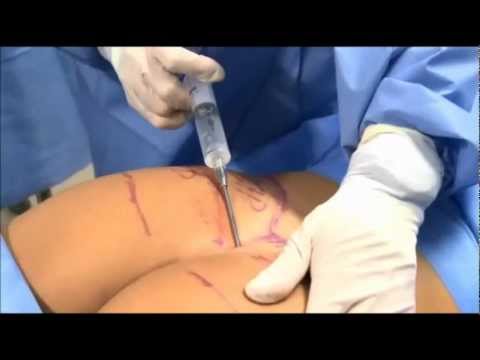 30 visualizações no youtube